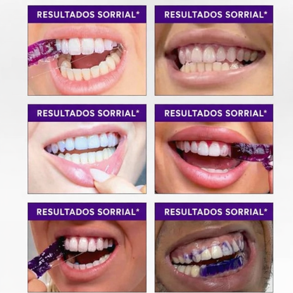 Sorrial Fitas Branqueadoras