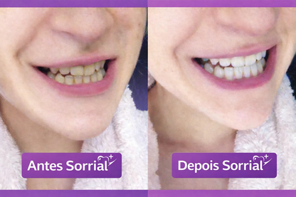 Sorrial Fitas Branqueadoras